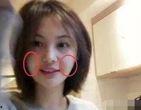 郑爽取出假体后的照片,取出假体后的清新自然美